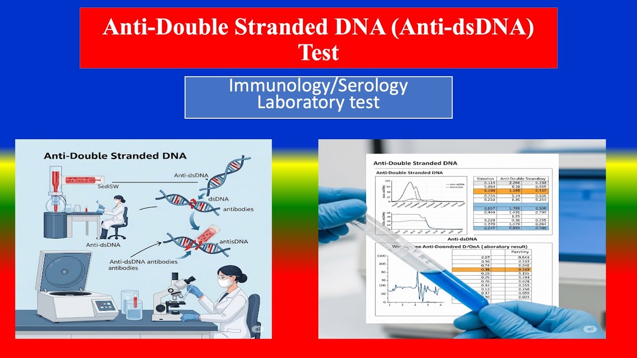 Anti-Double Stranded DNA (Anti-dsDNA) Test -   Definition , Uses , Need , Results  , Normal