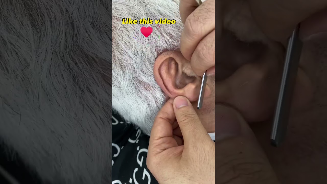 Ear shaving asmr ✅😳💈 #barber #barberworld #shaving #haircut #earshave #earcleaners #earshaving