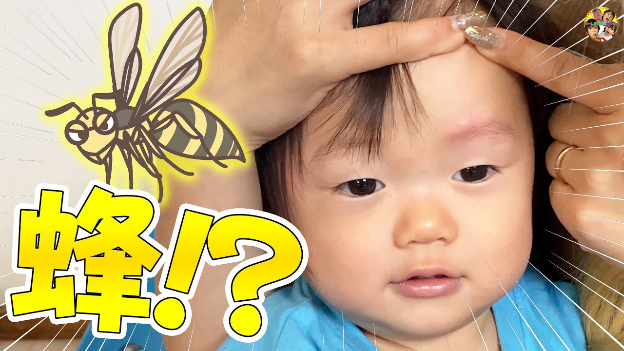【悲劇🐝】蜂に刺された！？😢💦三男みつきくんの顔や腕が腫れてきて…まさかの結末が…