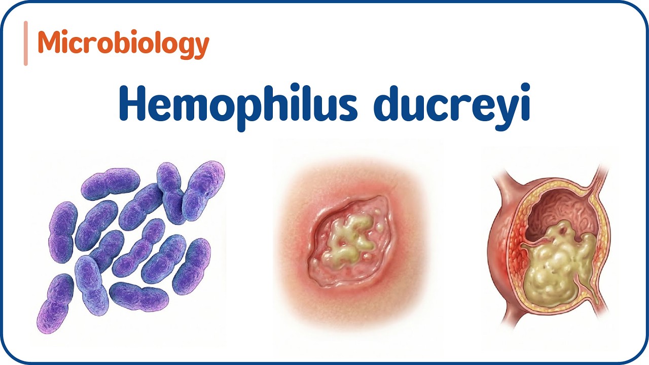 24. Hemophilus ducreyi 🦠 Шанкроид, болезненная язва и диагностика | USMLE & NEET-PG