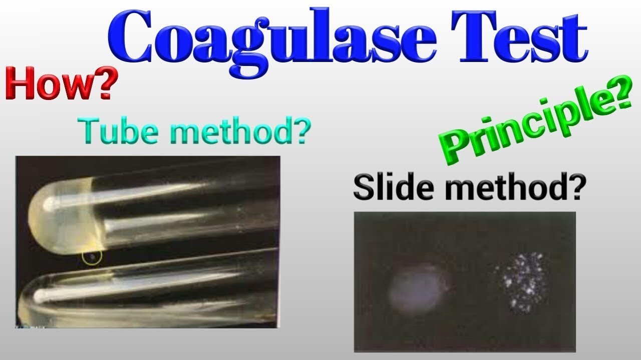 Coagulase Test