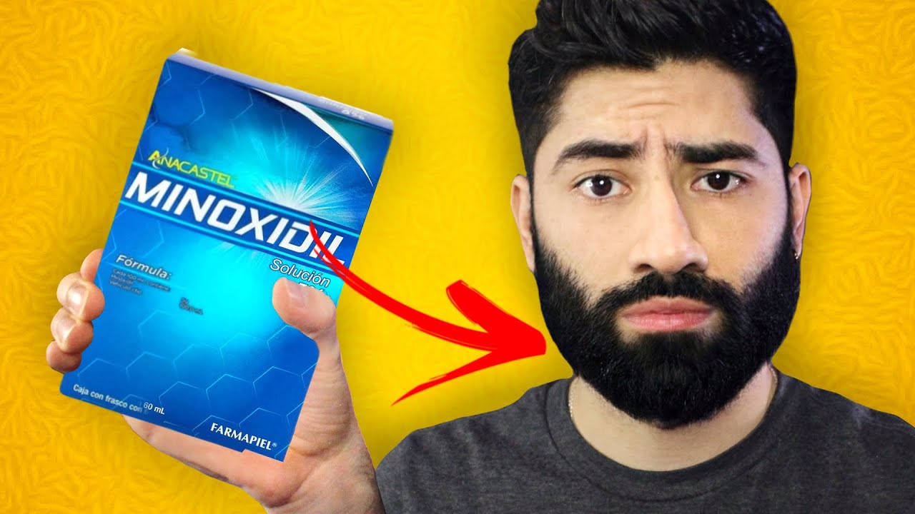 Usas minoxidil y NO mejora tu barba? HAZ ESTO