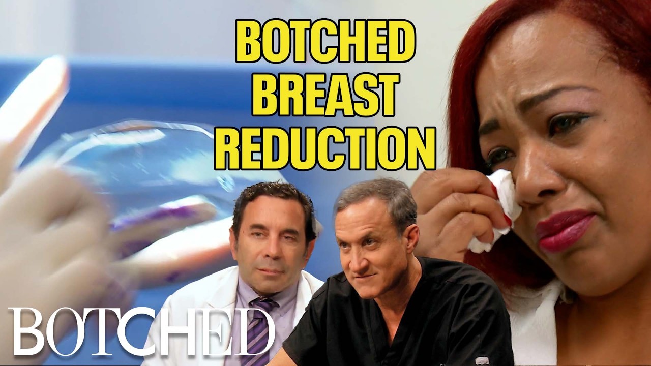 Botched Man Boobs?! Lauren's Breast Reduction Went Horribly Wrong (Before & After) | Botched | E!