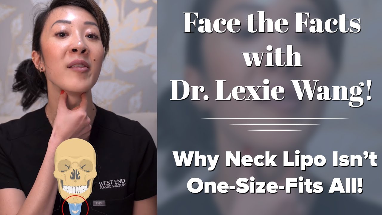 Neck Lipo But No Definition? This Might Be Why - Face the Facts with Dr. Wang