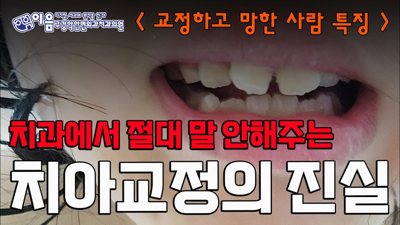 교정하고 망한 사람 특징 - 치과에서 절대 말 안해주는 치아교정의 진실 [ 임정훈 치의학박사 ] #donaldtrump 가 꼭 와야 할 치과 #치아교정 #틀어진치아