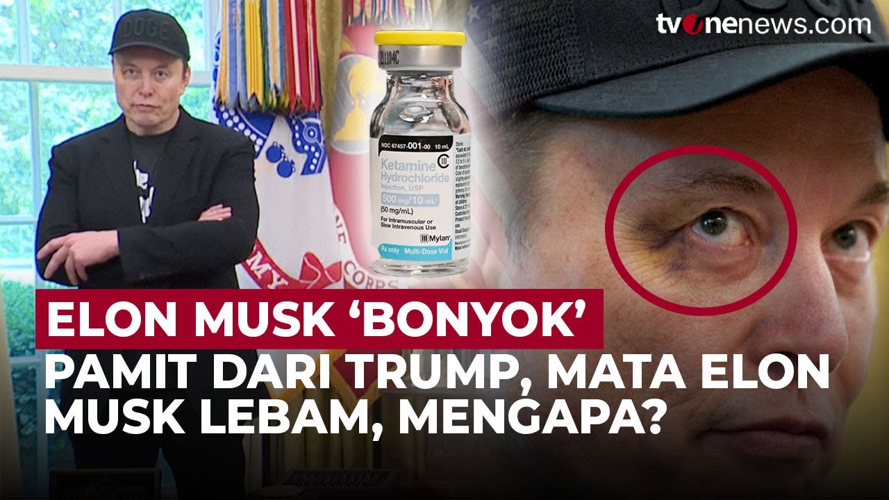 Elon Musk Tampil dengan Mata Lebam di Gedung Putih, Isu Narkoba Mencuat | OneNews Update