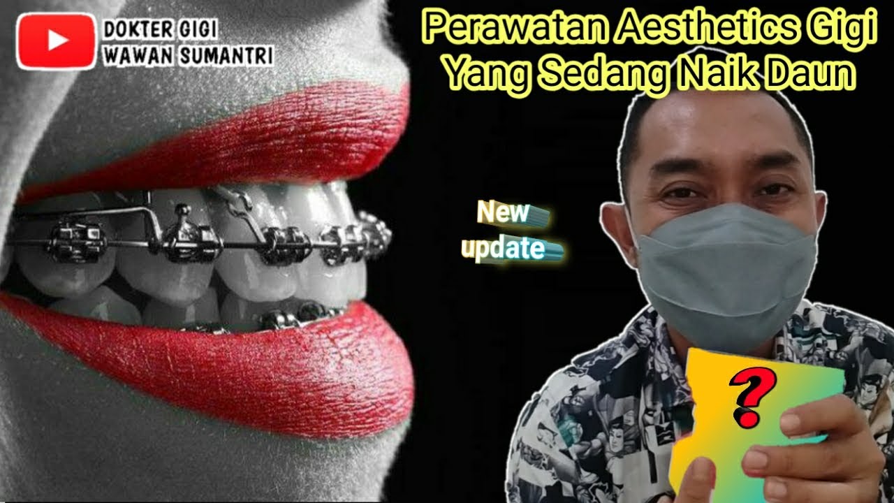 MANFAAT PERAWATAN ESTETIK GIGI JADI LIFESTYLE KEKINIAN DOKTER GIGI CHANNEL #doktergigi #aesthetic
