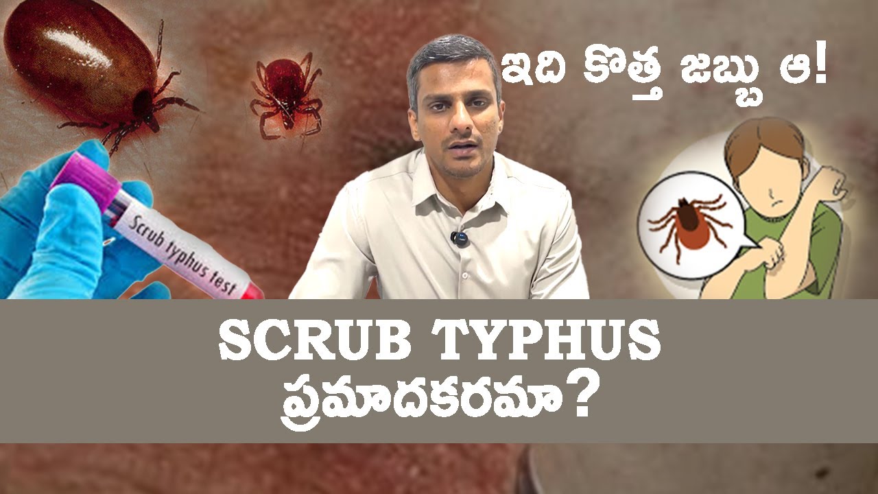 SCRUB TYPHUS Is This a New Disease! Is This Dangerous?