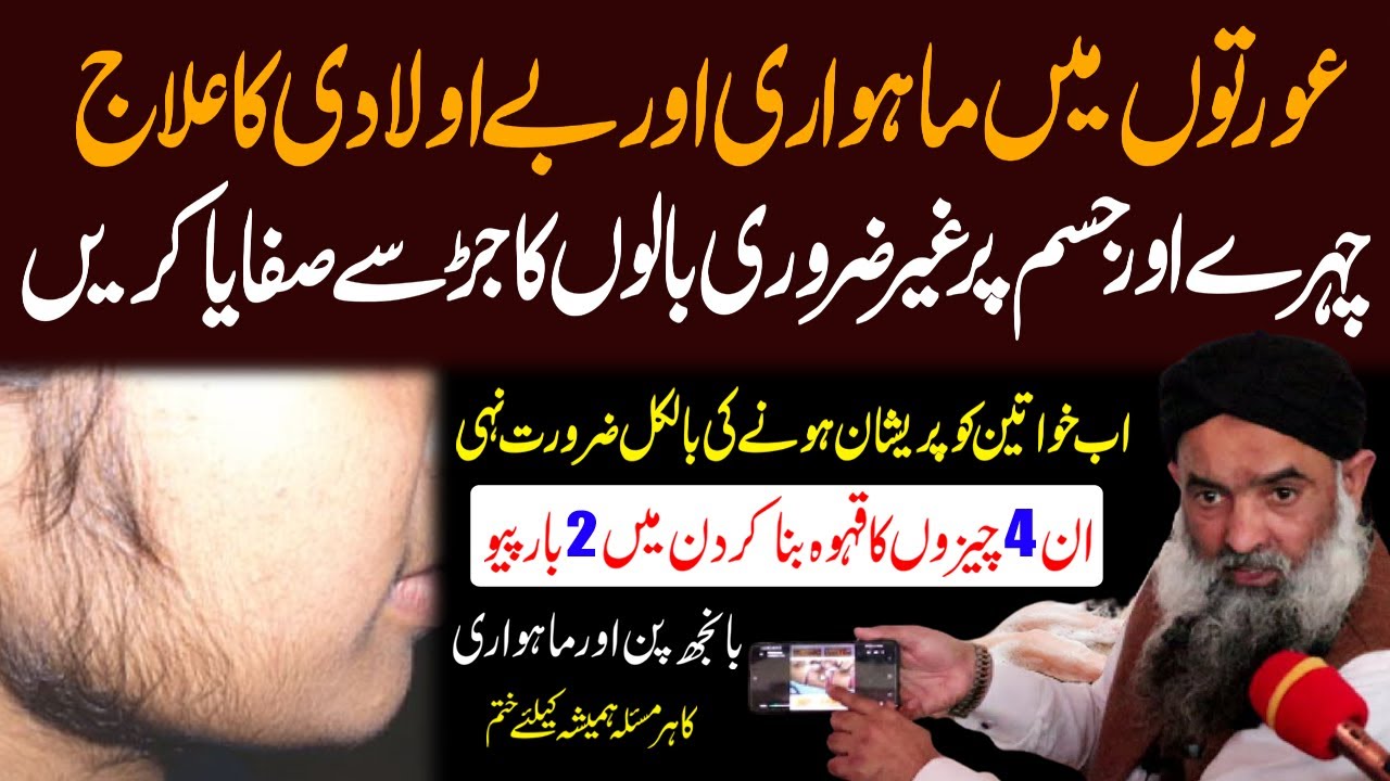 Hirsutism Treatment Urdu Hindi || Chehre Ke Balon Ka Ilaj || Dr Sharafat Ali