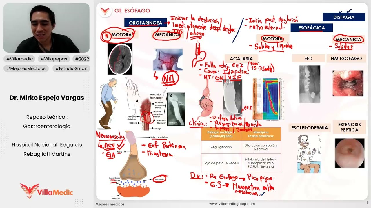 ESÓFAGO GENERALIDADES PARTE 2 - GASTROENTEROLOGÍA - VILLAMEDIC