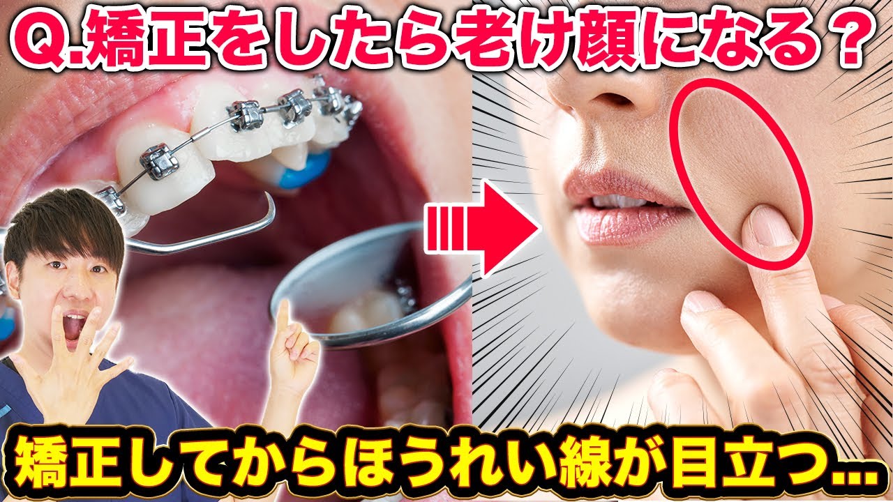 【矯正失敗】矯正すると頬がコケて老け顔になるって本当？【ワイヤー矯正/マウスピース矯正/抜歯矯正】