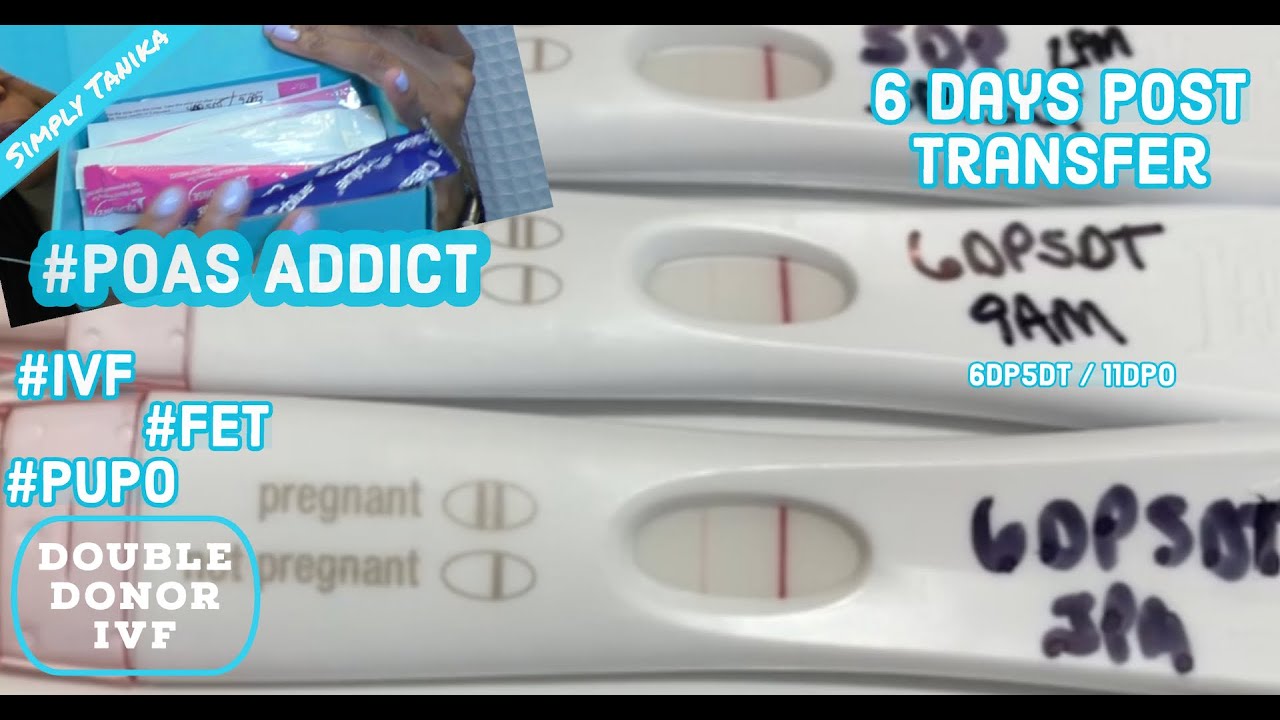 POAS Addict After IVF Transfer |  Simply Tanika | Donor Egg IVF | 11DPO