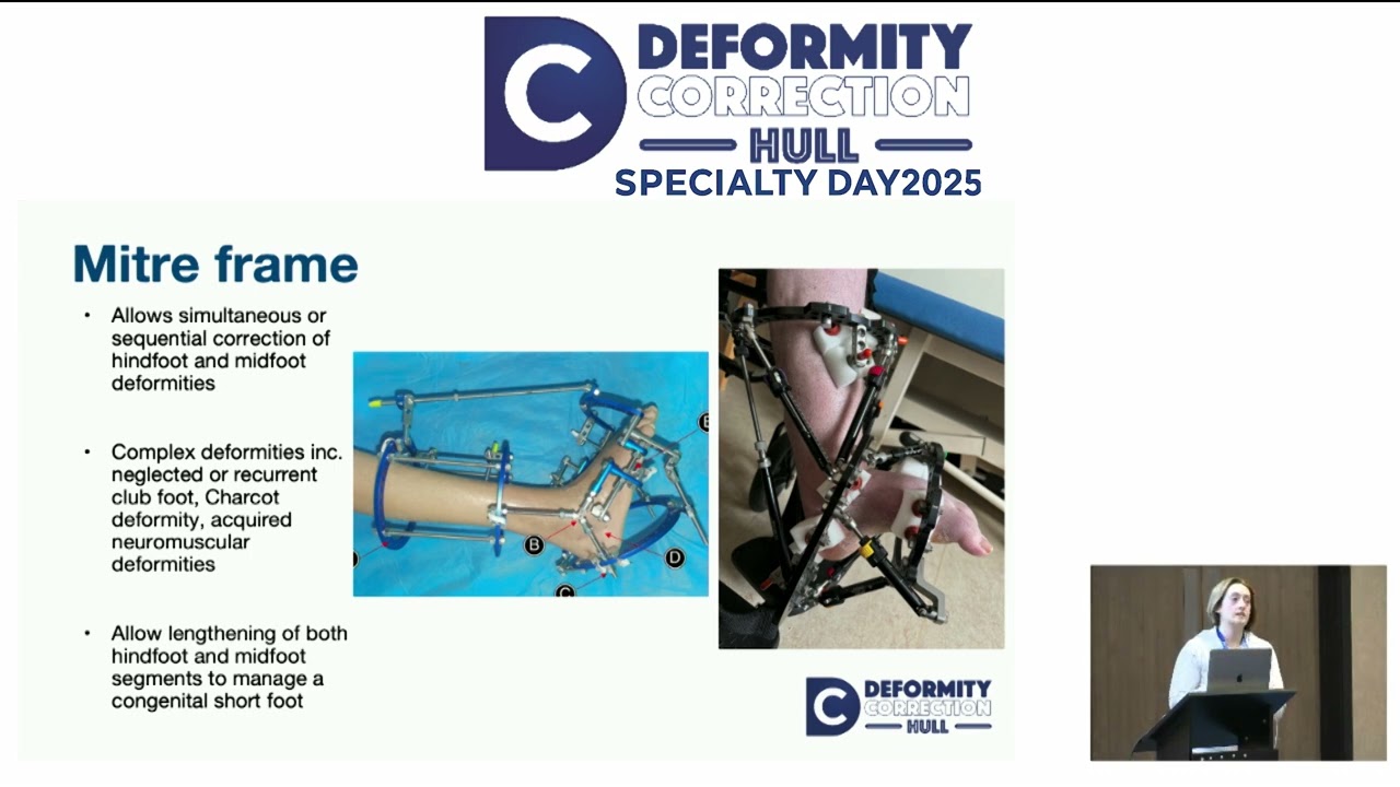 Frame   Hardware terminology and options?