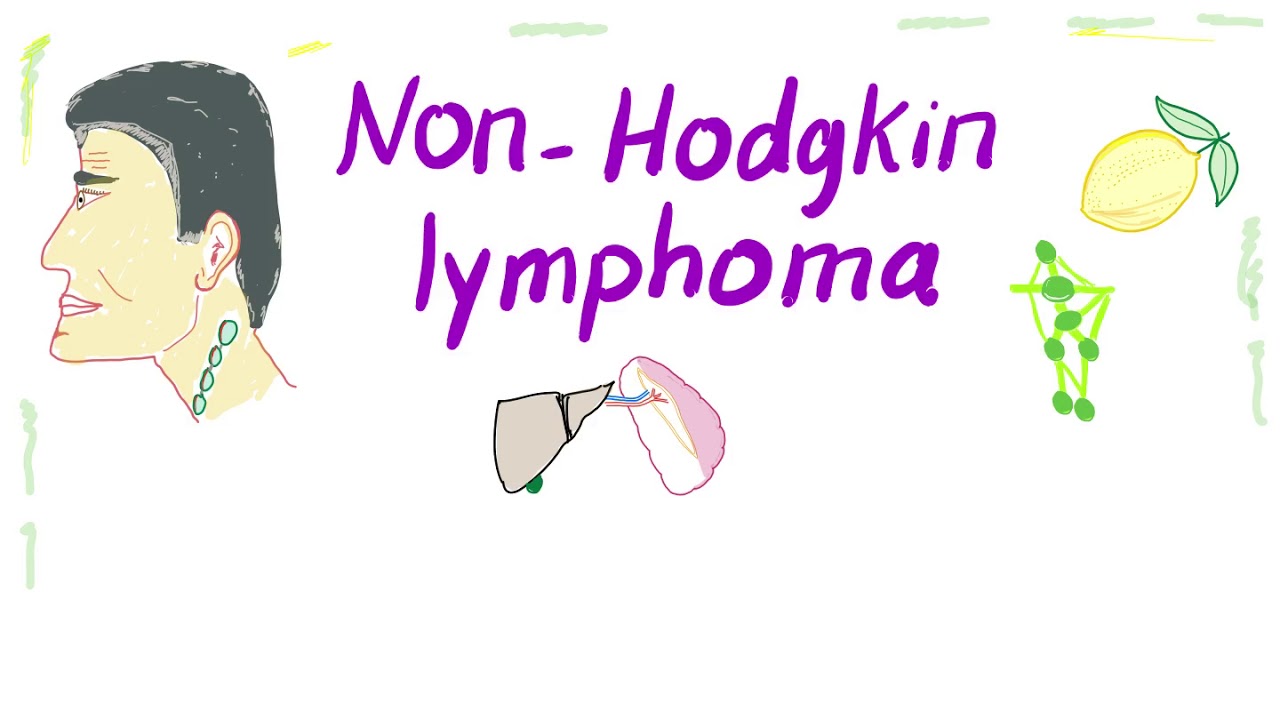 Non-Hodgkin's lymphoma (NHL) B-cell and T-cell | Aggressive and Indolent
