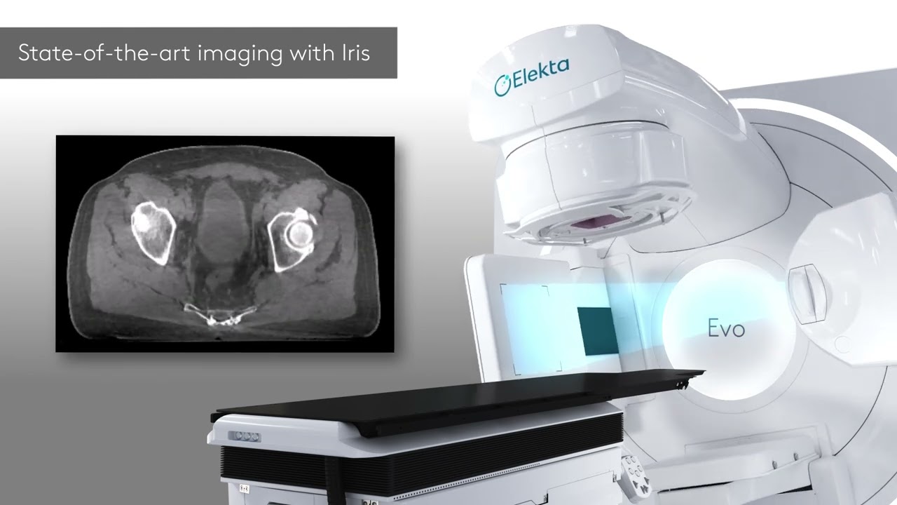 Elekta Evo Product Video