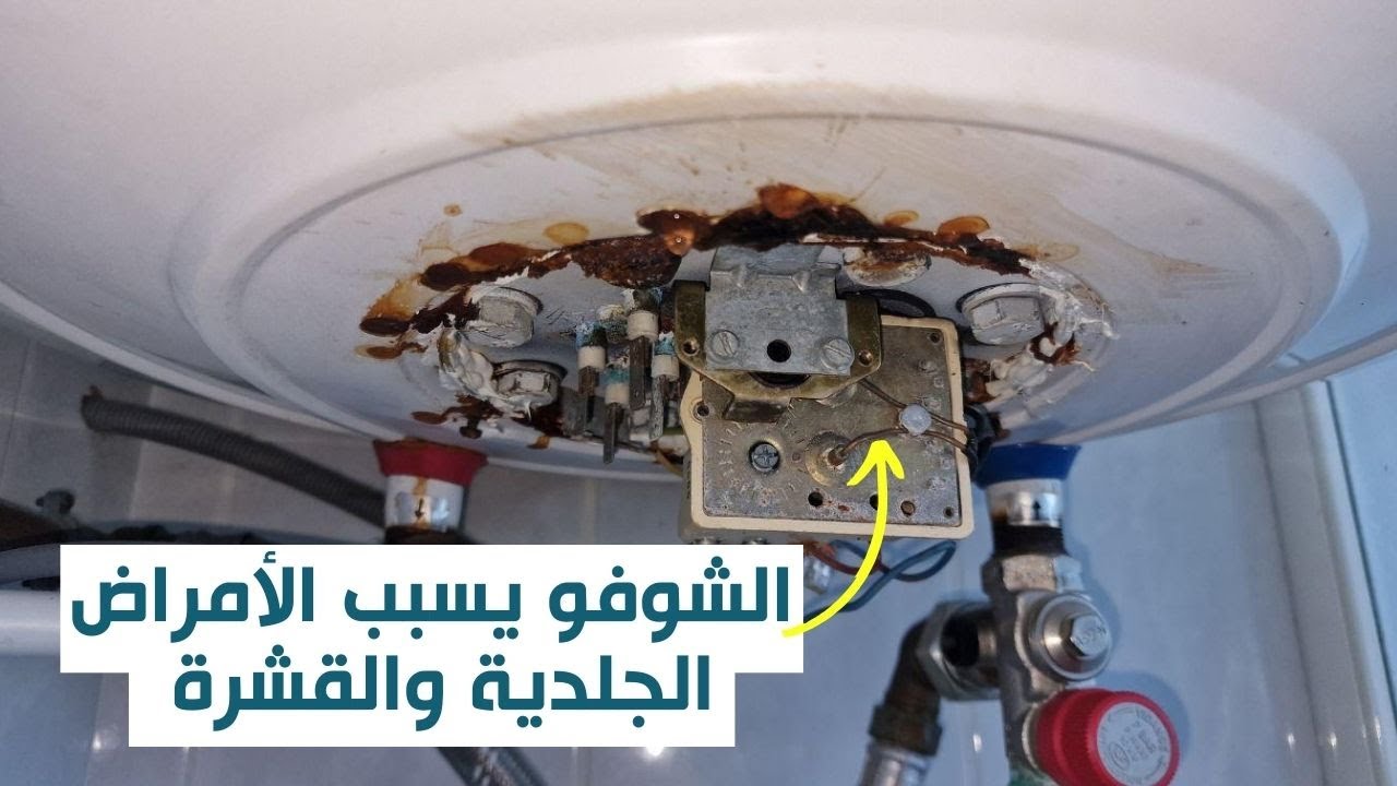 السخان الكهربائي يسبب الأمراض الجلدية والقشرة ؟