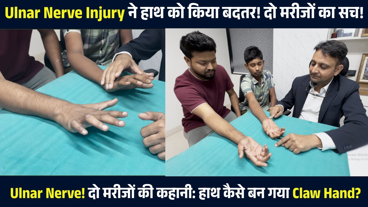 दो मरीज, एक चोट: Ulnar Nerve Damage ने हाथ कैसे किया खराब? | Ulnar Nerve Injury Treatment