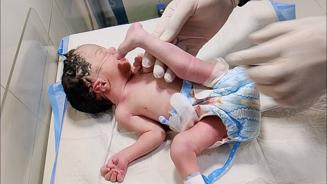 🏥 General NICU Care for Anomalous Baby✨ Anomalous Baby NICU Care Update
