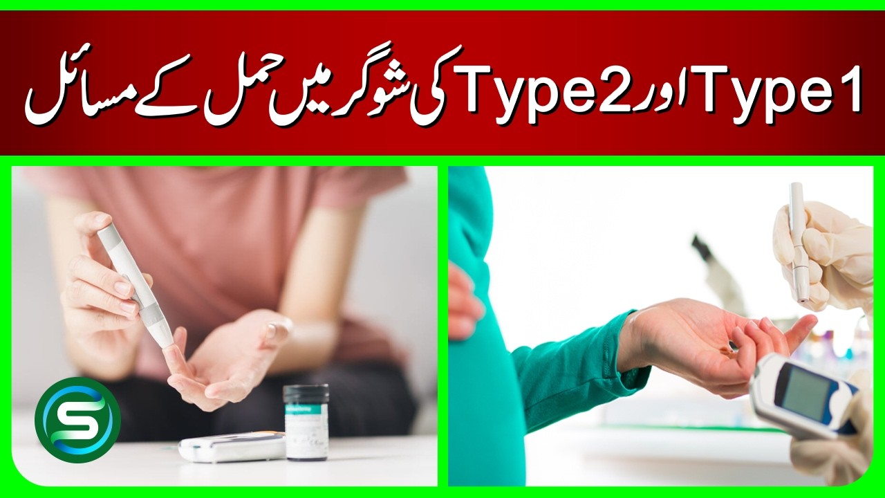 Pregnancy Complications in Type 1 & Type 2 Diabetes | Dr. Zahra Safdar (Gynecologist)