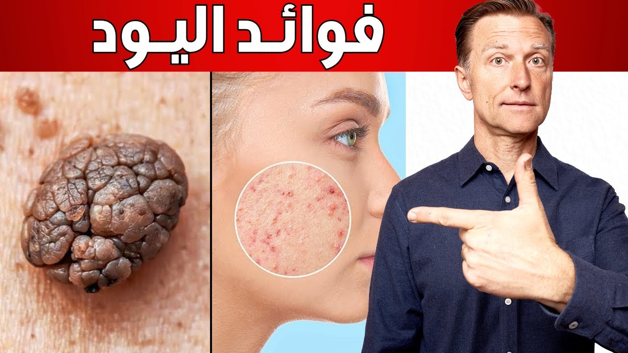 عجائب اليود: أكثر من مجرد غذاء للغدة الدرقية