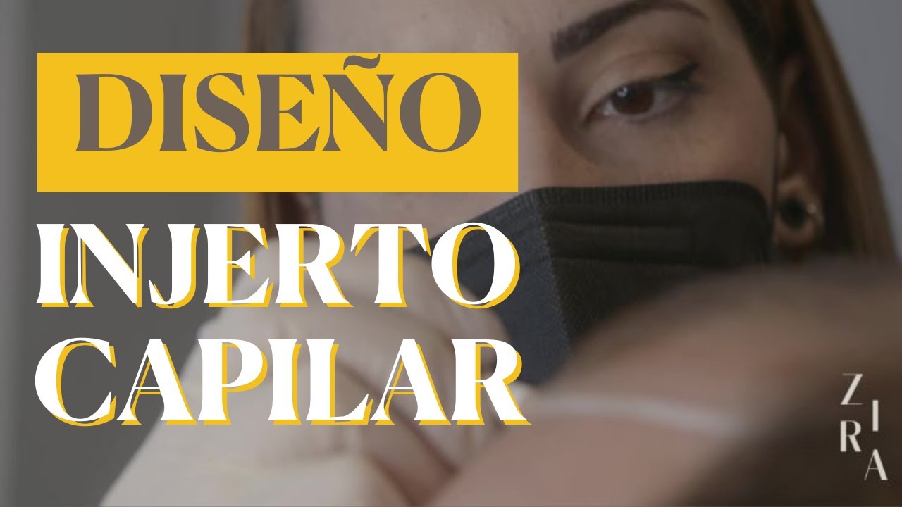 DISEÑO de LÍNEA FRONTAL en INJERTO CAPILAR 🠲 ¿Cómo conseguir una estética NATURAL?