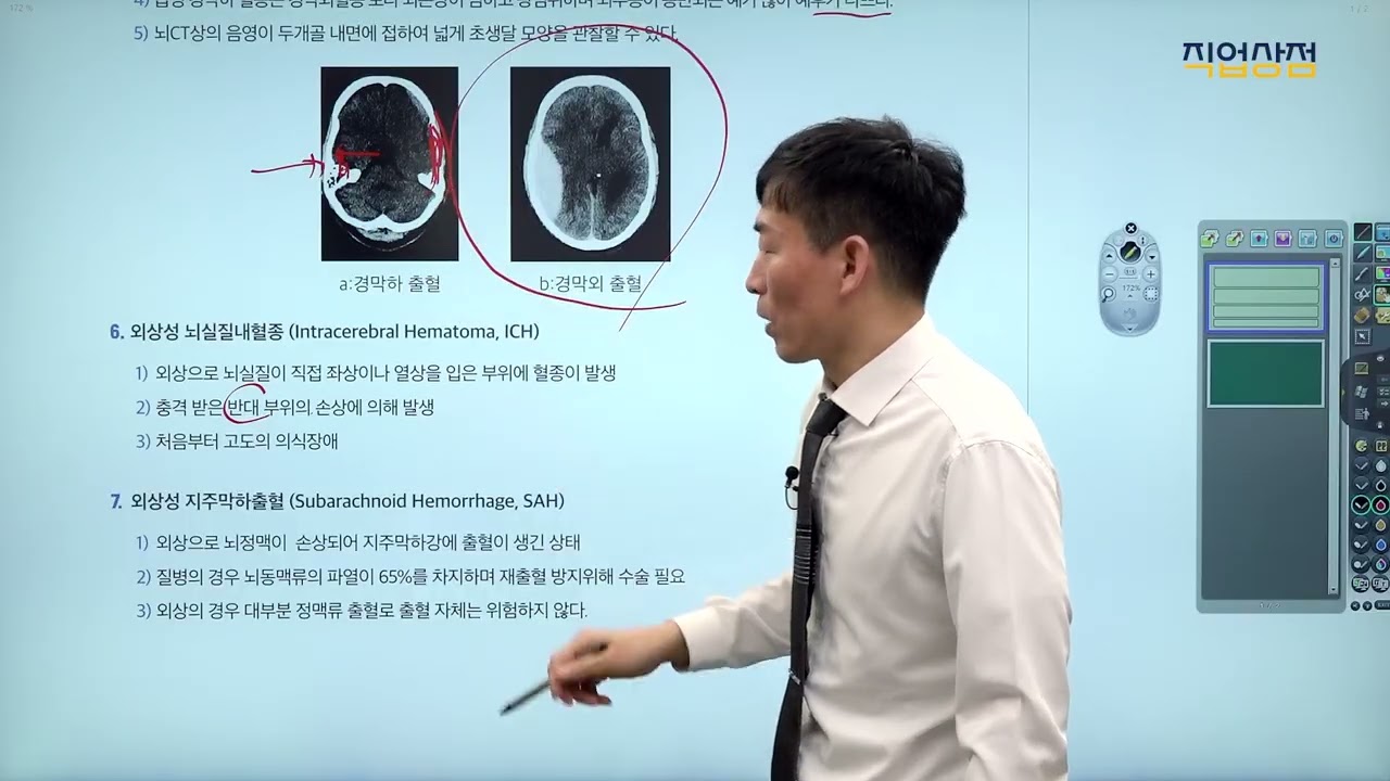 [손해사정사 무료강의] 2차 의학 11강 이론 - 두부골절