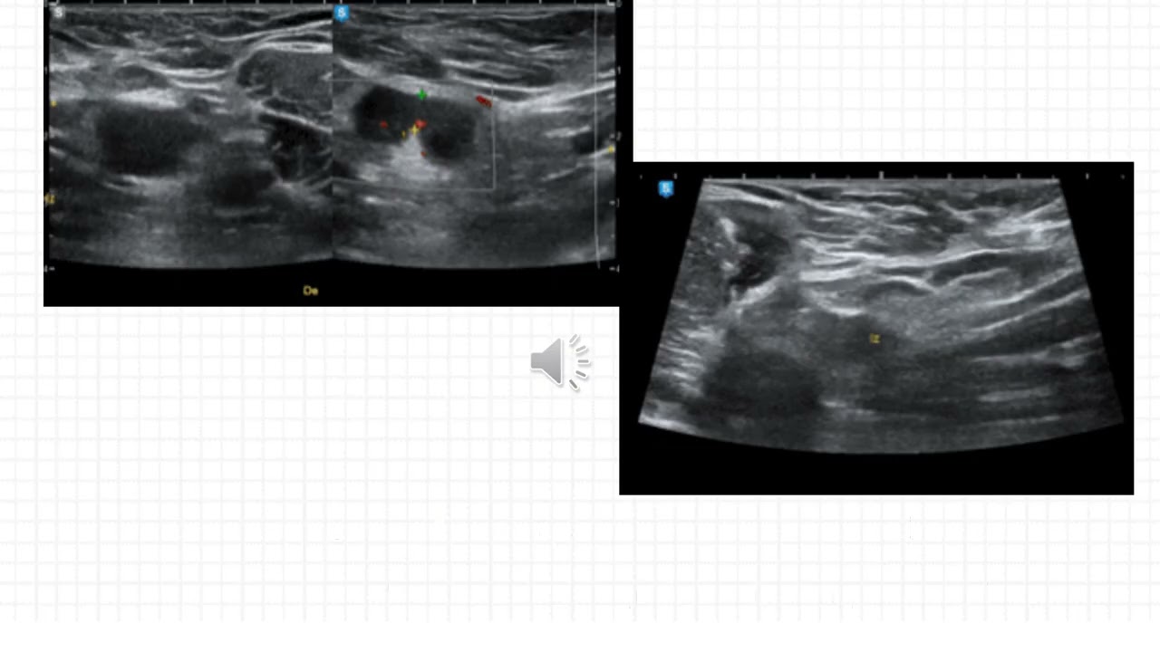Caso del Mes n°229 Octubre 2025 