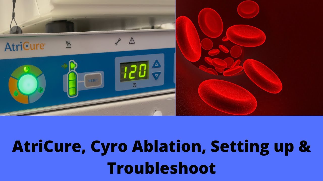 AtriCure, Cyro Ablation, Setting up & Troubleshoot