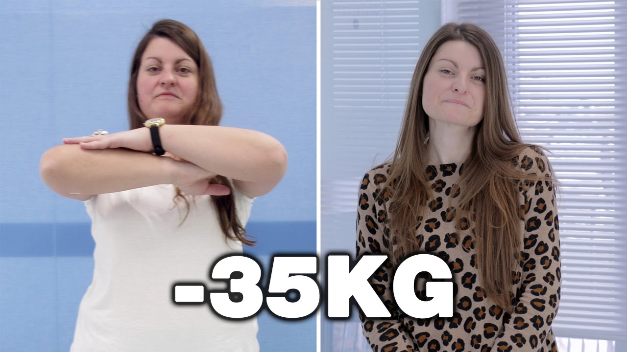 Método POSE Antes y Después | Testimonios Clínicas Diego de León