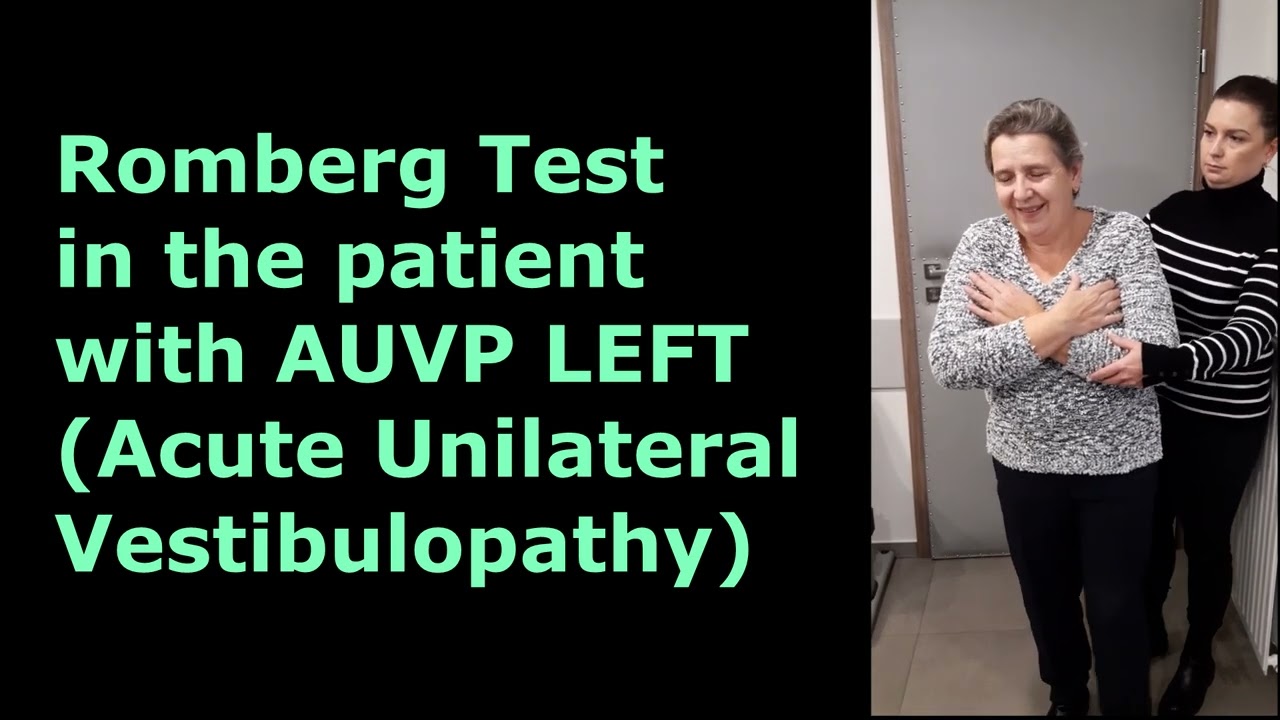 Romberg Test Explained| Acute Unilateral Vestibulopathy Left Side Case Study| Dr. Krystof