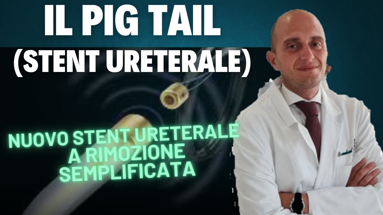 Stent ureterale: come funziona, come si rimuove. Tutto sul pig tail