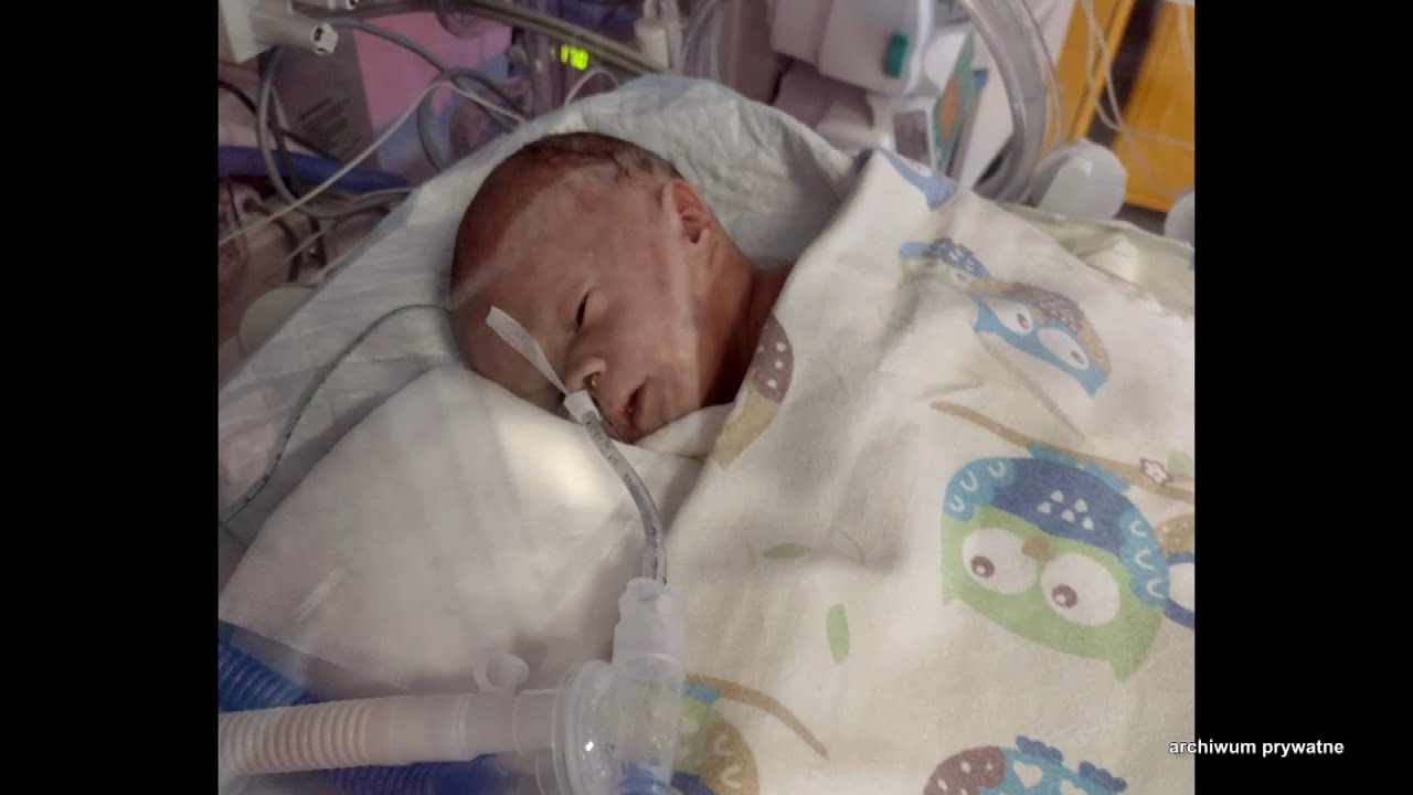 Nie żyje mała Zosia. Wstrząsające słowa lekarza: „Dzieci umierają, no i co z tego?” (UWAGA! TVN)
