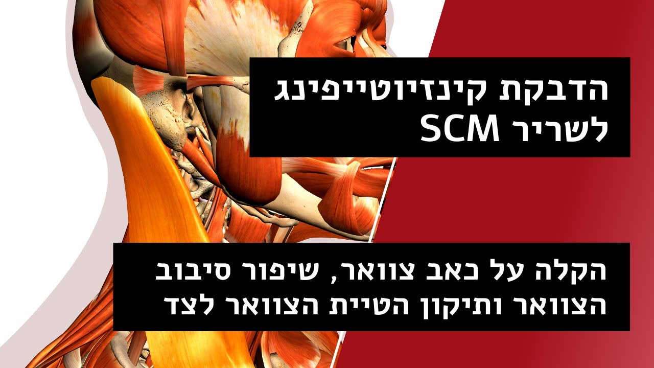 קינזיוטייפ לצוואר שריר SCM, להקלה על כאב, רוטציה של הראש ויישור הטיית הראש הצידה