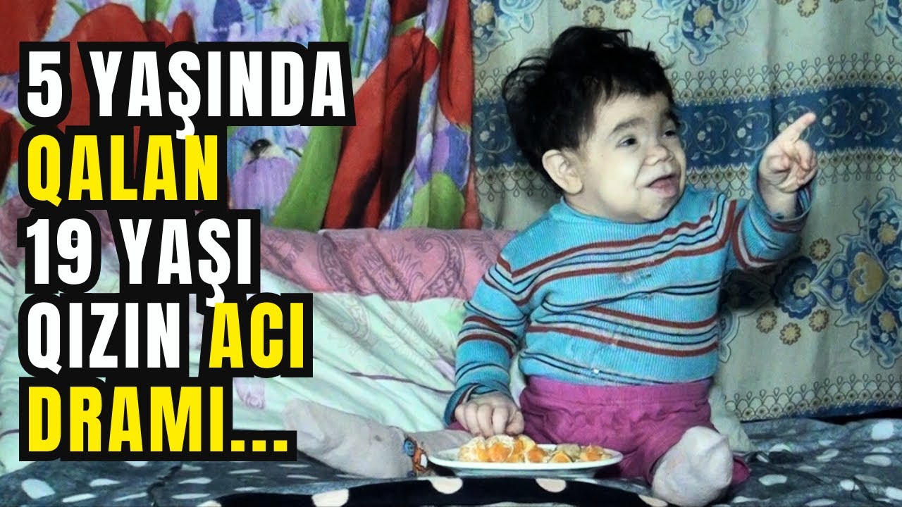 Bədəni Böyüməyən 19 yaşlı qızın Həyat Hekayəsi 2-ci Hissə | Rəhman Məlikli