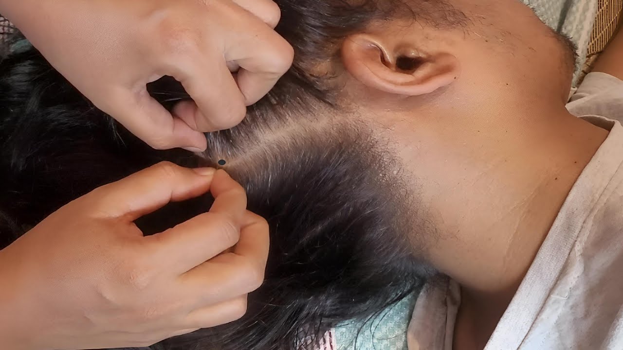 Scalp Check ASMR - A Tingly Sleep Experience✨