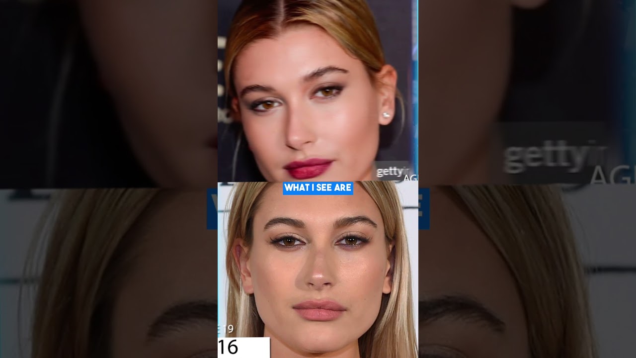 Did Hailey Bieber Have Plastic Surgery