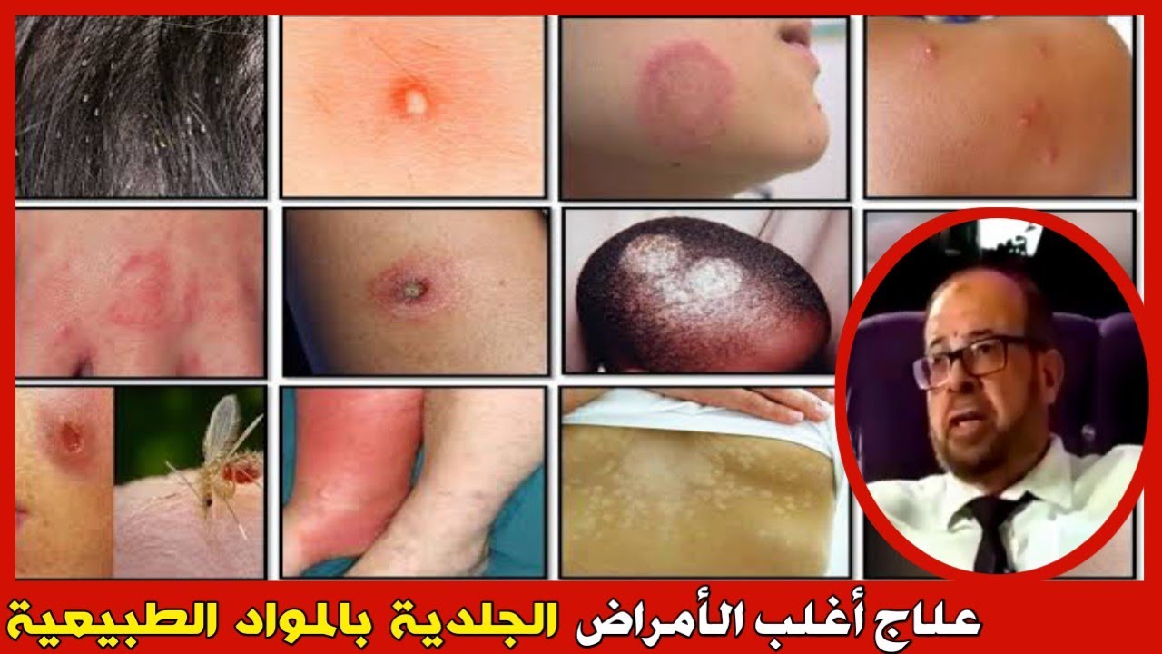 أفضل العلاجات الجلدية على الإطلاق | دكتور جودة محمد عواد | دكتور جودة محمد عواد