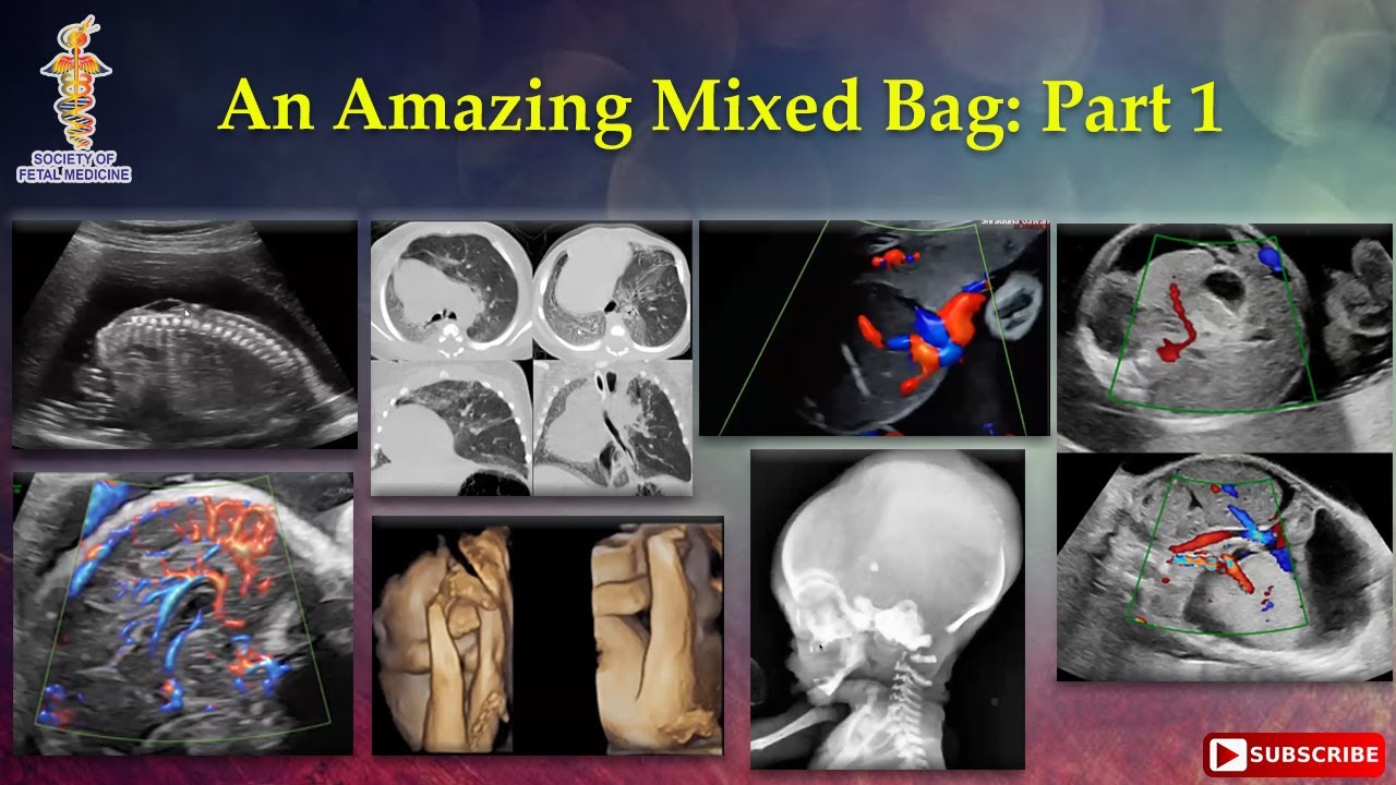 An Amazing Mixed Bag: Part 1
