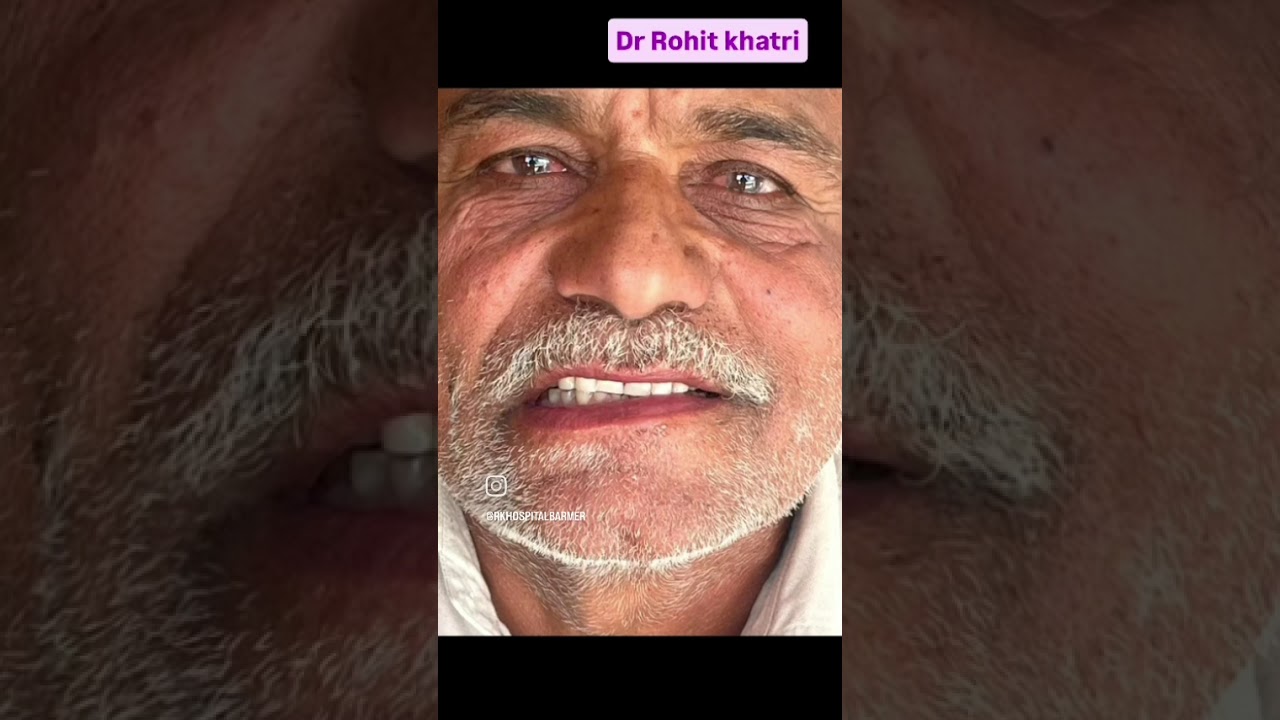Lower arch rehabilitation with raising vertical height of teeth