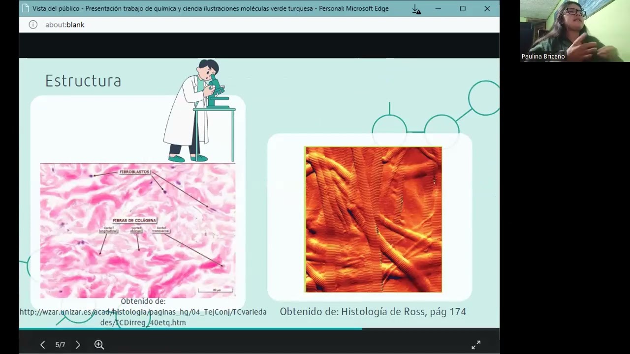 Tejido Denso Irregular- Tejido Conectivo