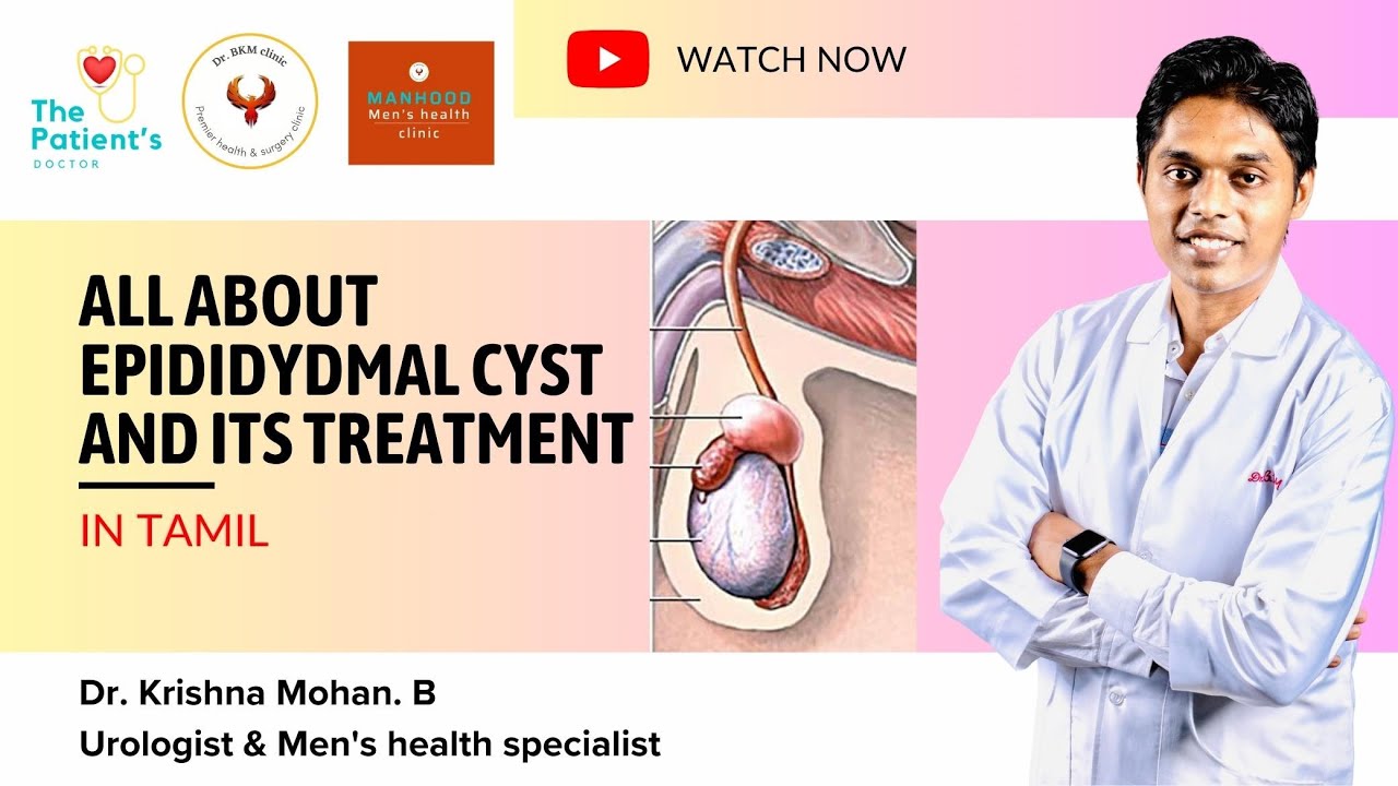 All about Epididymal cyst and its treatment in Tamil by Urologist and Mens health specialist #health