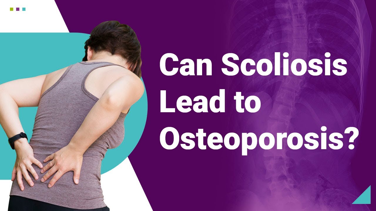 Can Scoliosis Lead to Osteoporosis?