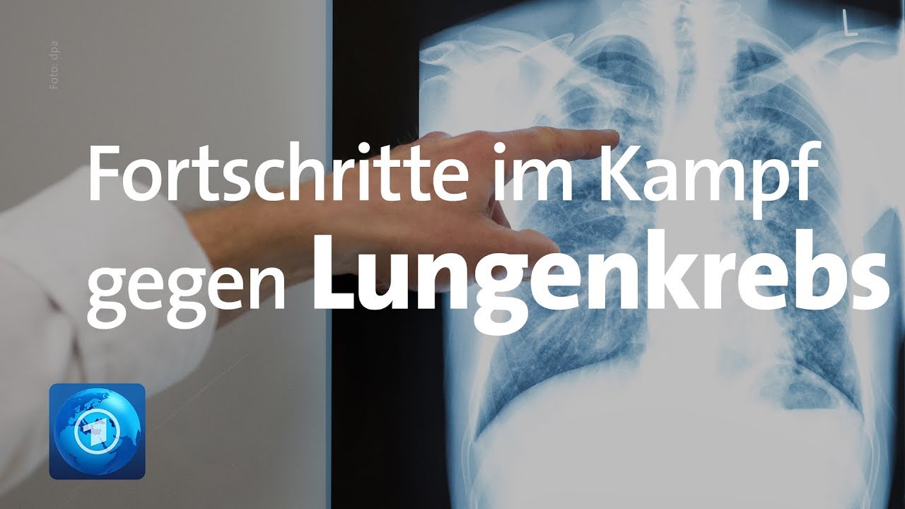 Fortschritte im Kampf gegen Lungenkrebs
