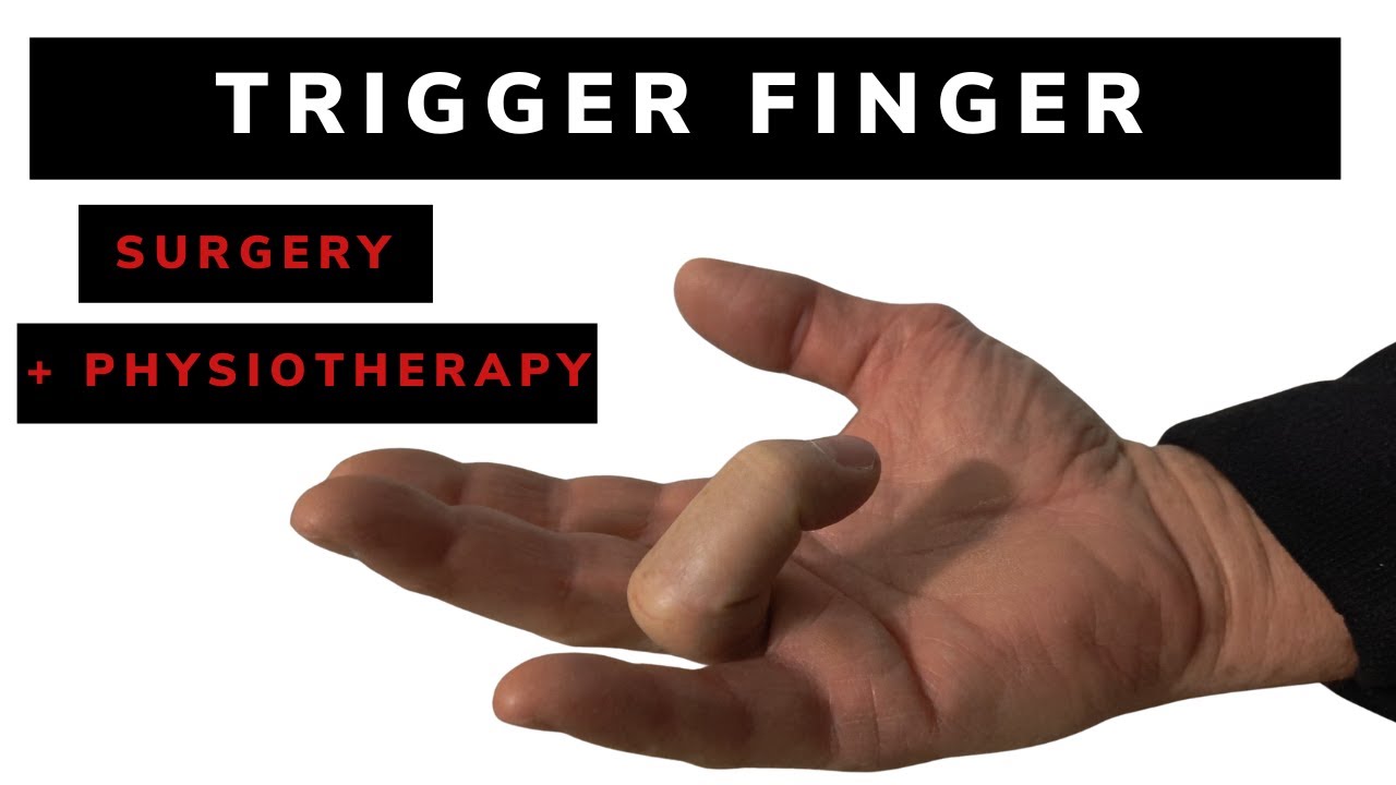 Tigger finger treatment: surgery and physiotherapy