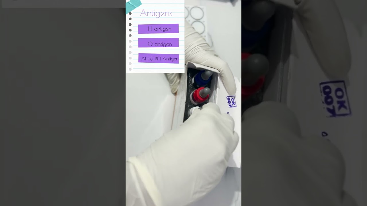 Widal Test Procedure |How Typhoid is Diagnosed #lab #laboratory #cls #mls #medtechstudent #shortvide