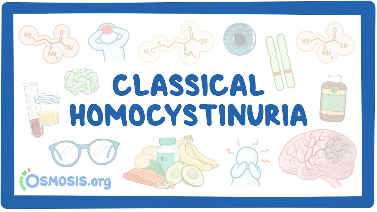 Classical Homocystinuria (NORD)