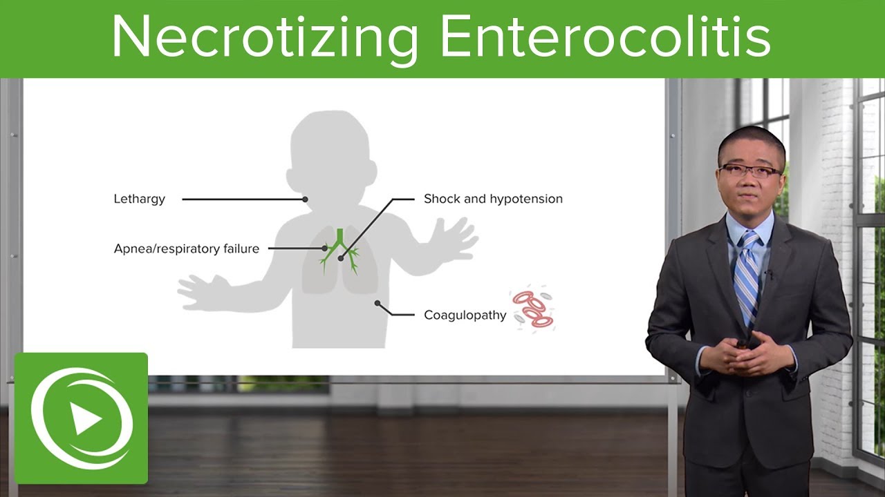 Necrotizing Enterocolitis &ndash; Surgery | Lecturio