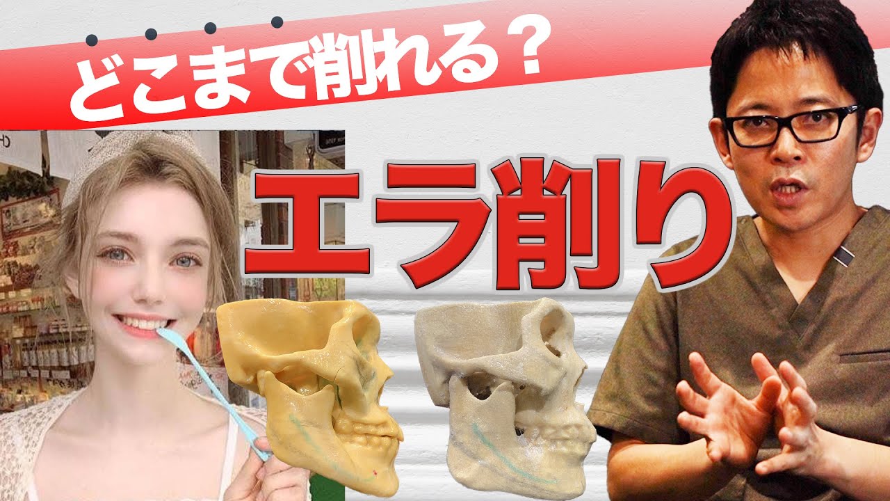 【小顔になりたいエラ削り！】どこまで削れるのか？実際の骨モデルとCTで解説