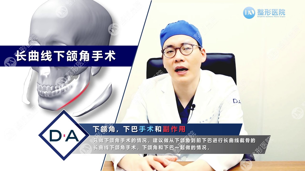 下颌角手术、下巴手术及副作用