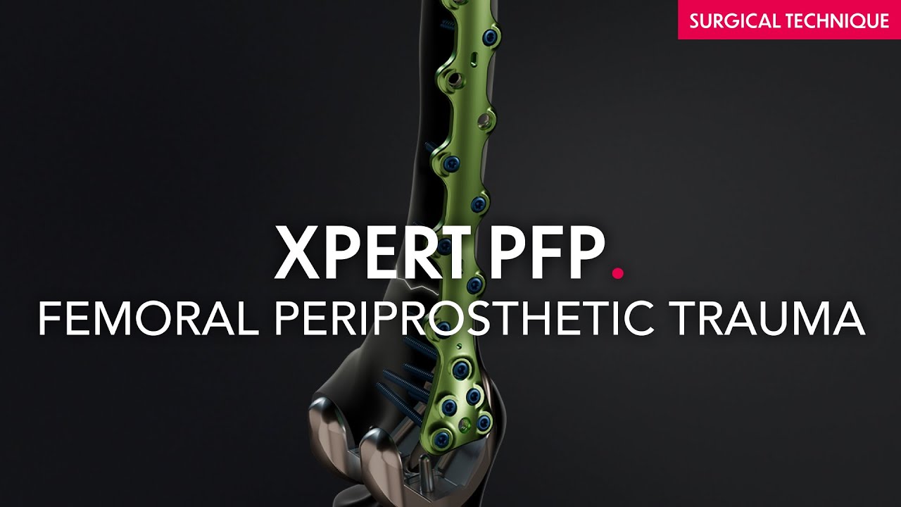 Xpert PFP - Periprosthetic femoral plates - Surgical technique